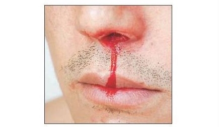 nose_1&nbsp;&nbsp;H x W: 