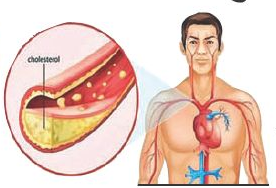 cholesterol _1  