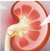 Kidney