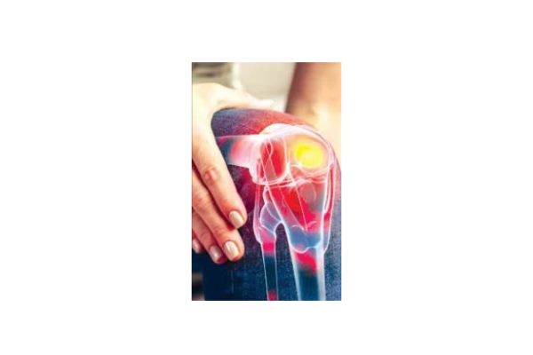 KneePain