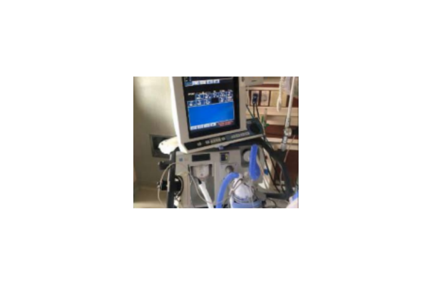 ventilator